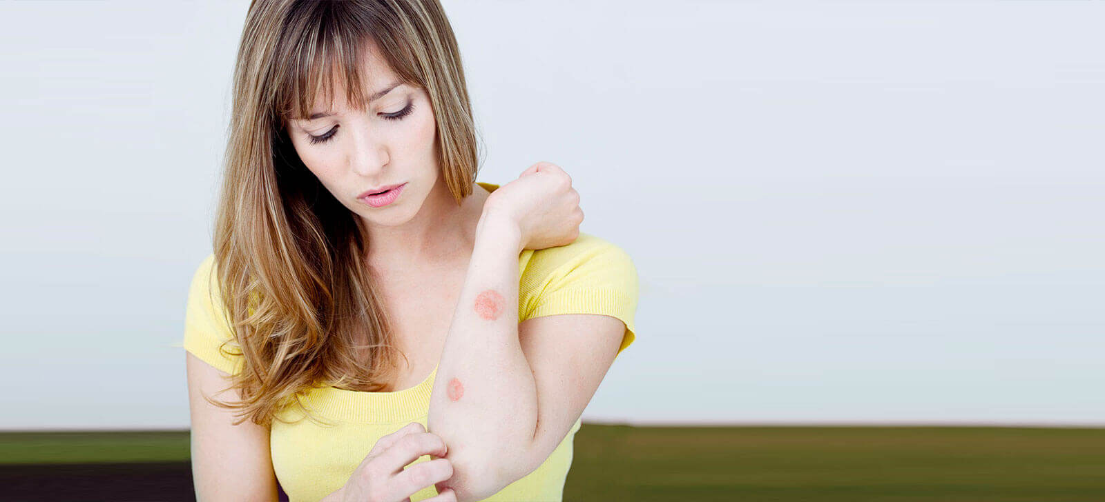 Micose de pele: descubra o que é, as causas e tratamentos