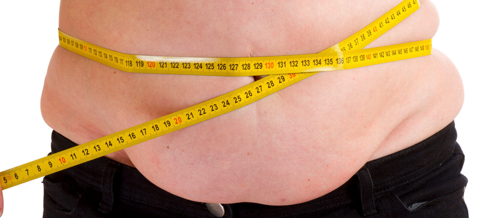 Obesidade: o que é, como prevenir, sintomas e tratamentos