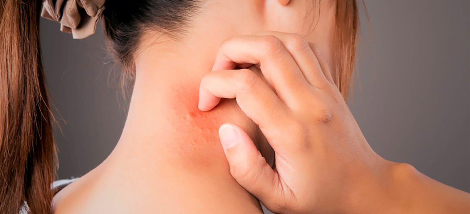 Conheça as alergias de pele mais comuns e seus tratamentos
